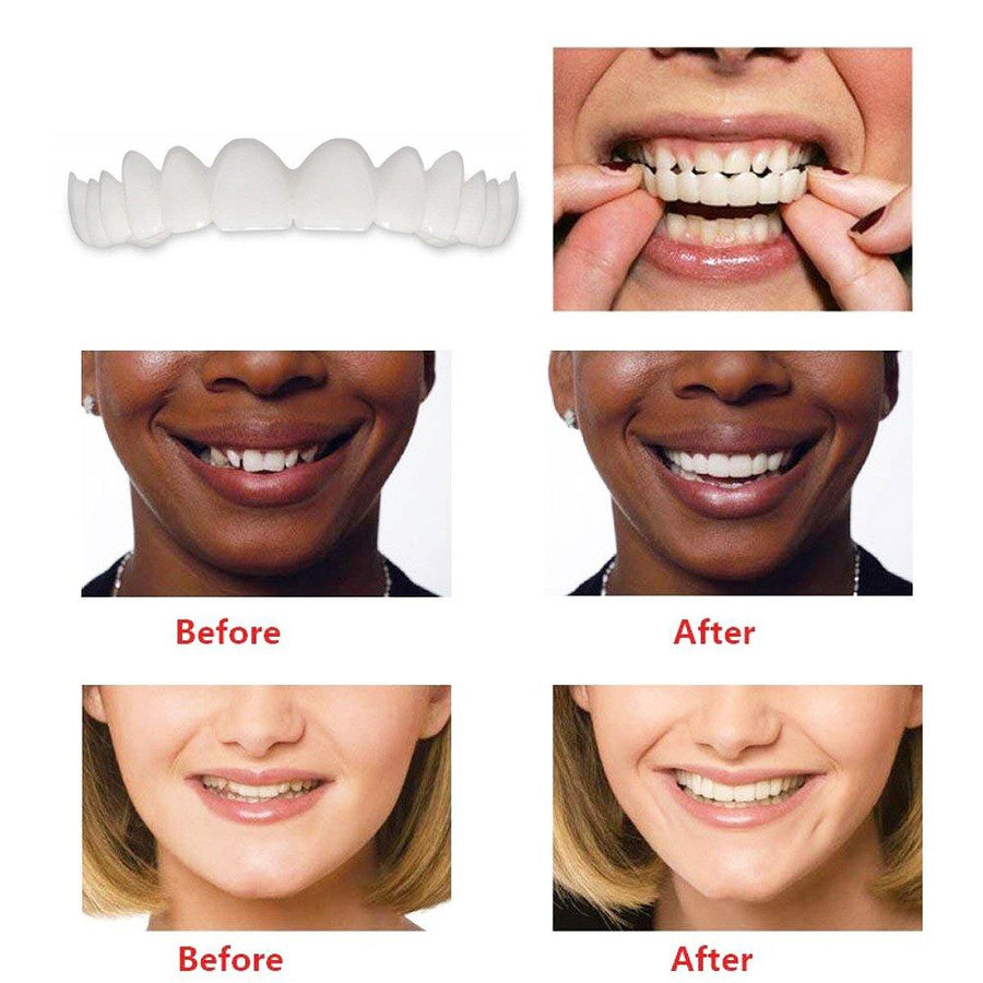 1 Pair Dentistry Cosmetic Covers Smile Comfort Veneers Flex Teeth Braces Upper +Bottom - MRSLM